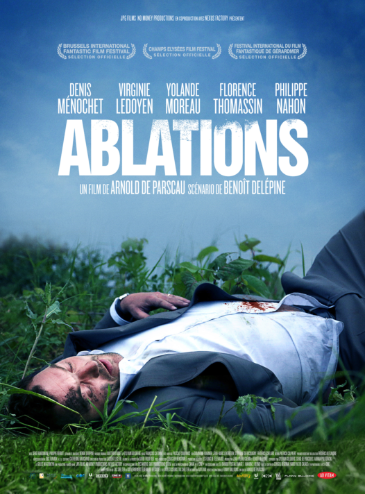 Ablations